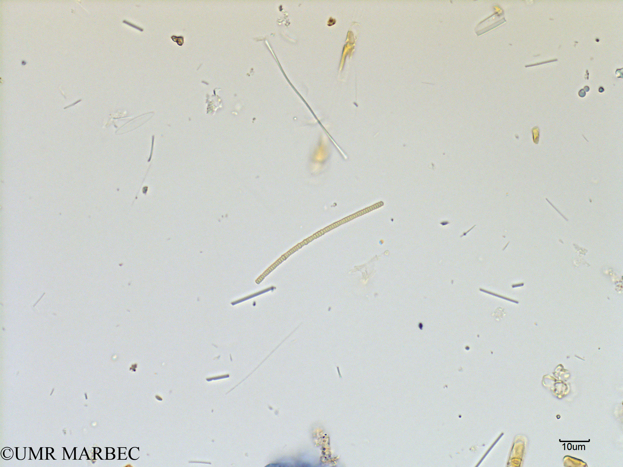 phyto/Scattered_Islands/mayotte_lagoon/SIREME May 2016/Oscillatoriale spp (MAY7_cyano petite2).tif(copy).jpg